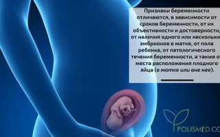 Признаки беременности — достоверные и ложные, ранние и поздние. Критерии определения мальчика и девочки. Внематочная, замершая и ложная беременности — важные аспекты для будущих родителей.