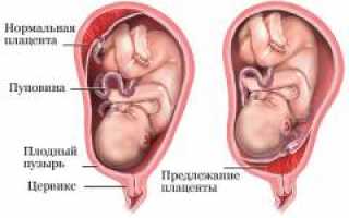 Кесарево сечение. Показания, противопоказания, осложнения и рекомендации
