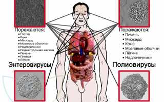Энтеровирусная инфекция. Причины, симптомы, диагностика и лечение заболевания у взрослых и детей.
