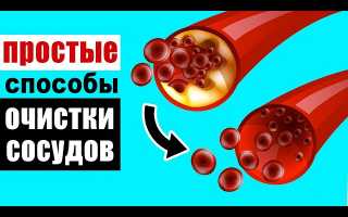 Естественные механизмы чистки сосудов — как включить их в полную силу для здоровья?
