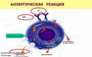 Анафилактический шок. Причины, симптомы, алгоритм оказания первой неотложной помощи, лечение, профилактика и важные рекомендации.
