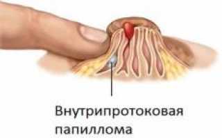 Маммолог. Чем занимается данный специалист, какие исследования производит, какие патологии лечит и как это важно для здоровья?