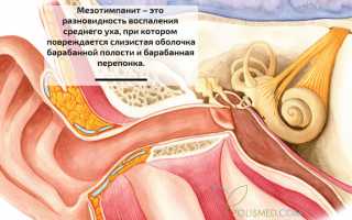 Мезотимпанит (хроническое воспаление среднего уха). Причины воспаления, симптомы, диагностика, лечение патологии и рекомендации