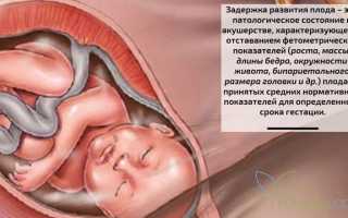Задержка развития плода: причины, симптомы, диагностика, профилактика и лечение патологии для будущих родителей