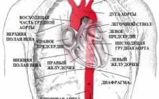 Аневризма грудной аорты. Симптомы, диагностика и лечение патологии у пациентов