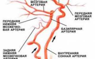 Мигрень — причины, симптомы, диагностика и лечение болезни, советы и рекомендации
