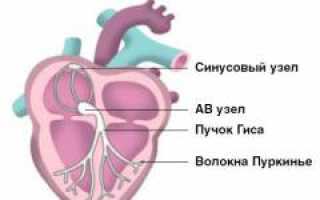Мерцательная аритмия. Причины, симптомы, диагностика и лечение заболевания у пациентов.