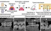 Регенерация новых молодых зубов у человека: технологии и практика
