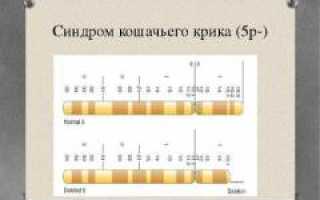 Синдром кошачьего крика: причины, симптомы, признаки, диагностика и лечение патологии у животных