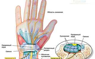 Почему немеют руки, ноги и пальцы? 12 основных причин онемения и их последствия