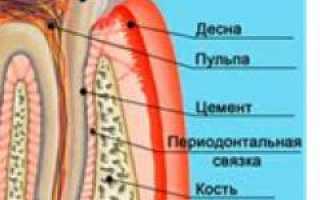 Пульпит острый и хронический — причины, симптомы, диагностика, осложнения и лечение пульпита. Виды пульпита: фибринозный, гангренозный, гнойный, гипертрофический и их особенности.