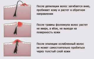 Техника проведения депиляции рук воском в домашних условиях
