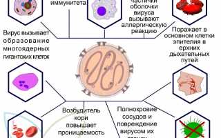 Корь. Причины, симптомы, диагностика и лечение заболевания у детей