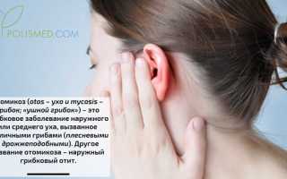 Отомикоз (грибковая инфекция уха). Причины воспаления, симптомы, диагностика и лечение патологии у взрослых и детей