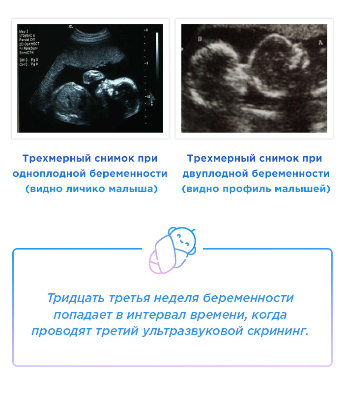 УЗИ снимки