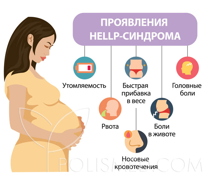 HELLP синдром