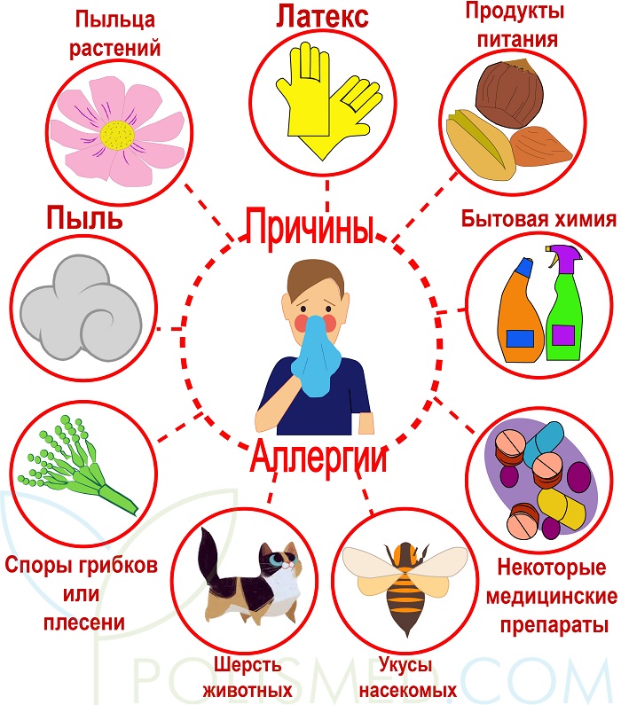Причины аллергии