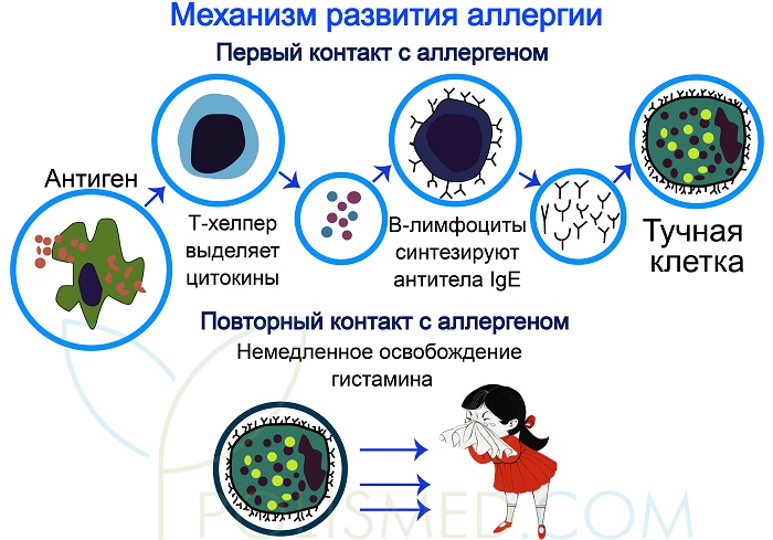 Механизм развития аллергии