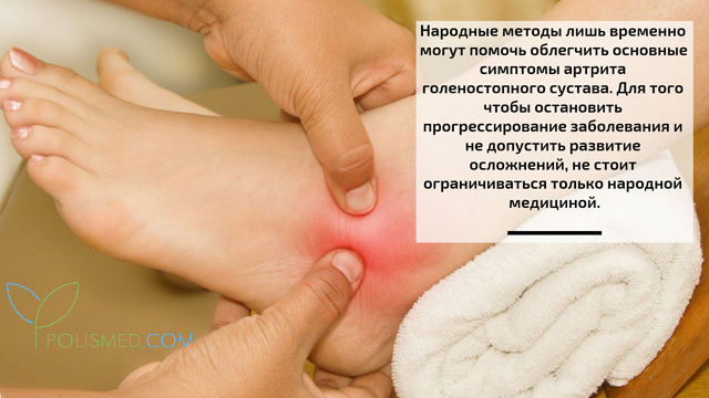 Народные средства лечения артрит голеностопного сустава