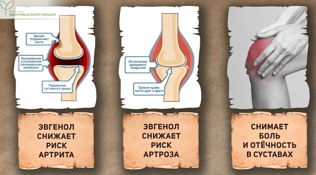 профилактика болезней суставов