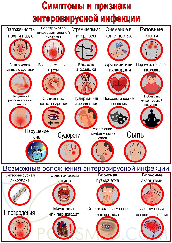 Симптомы и признаки энтеровируса