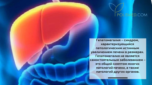 Гепатомегалия