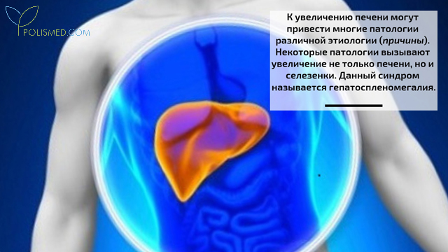 Формы и причины гепатомегалии