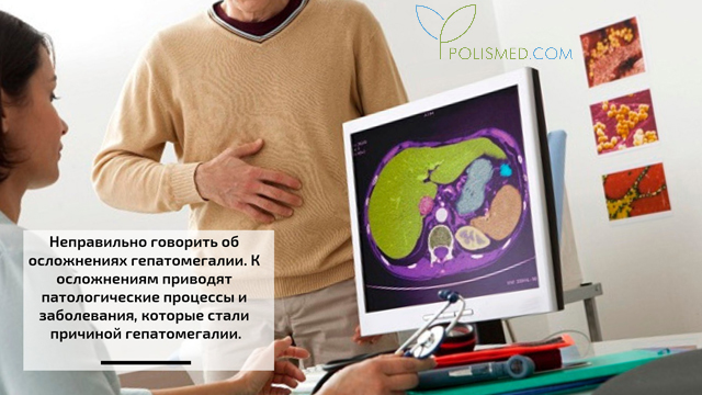 Последствия гепатомегалии