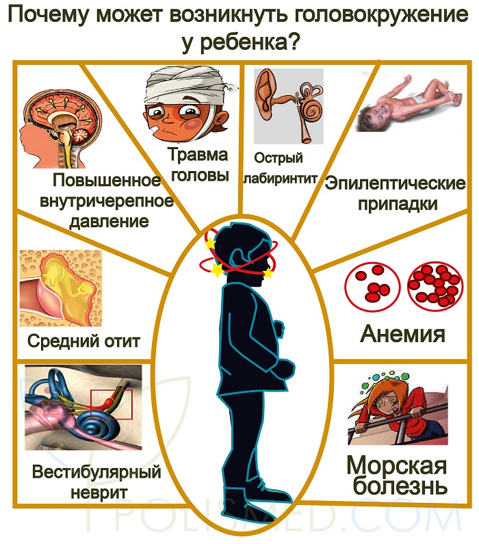 Причины головокружения у детей