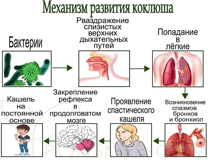 Механизм развития коклюша