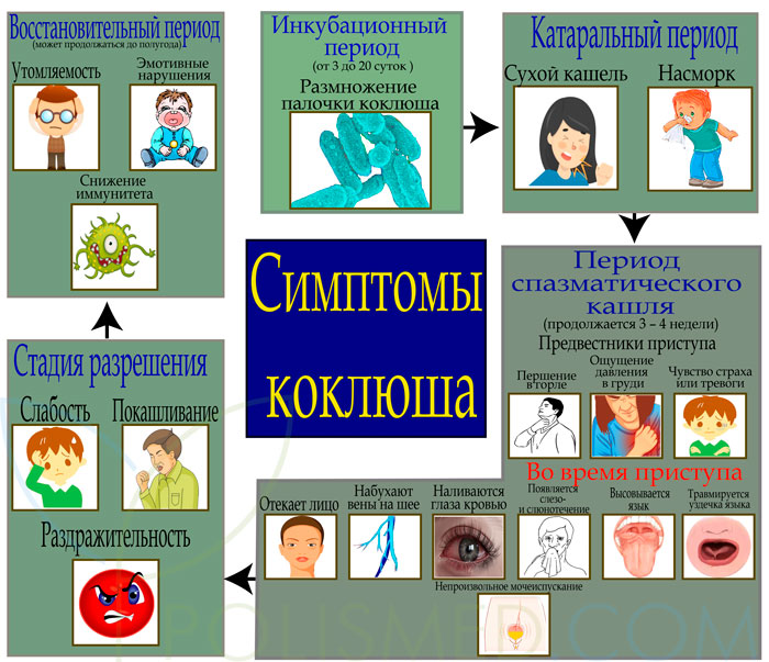 Симптомы коклюша