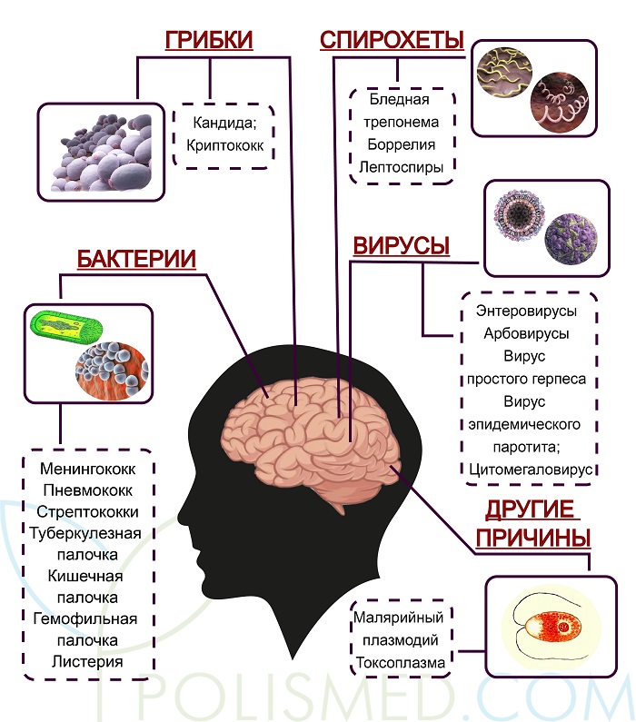 Причины менингита