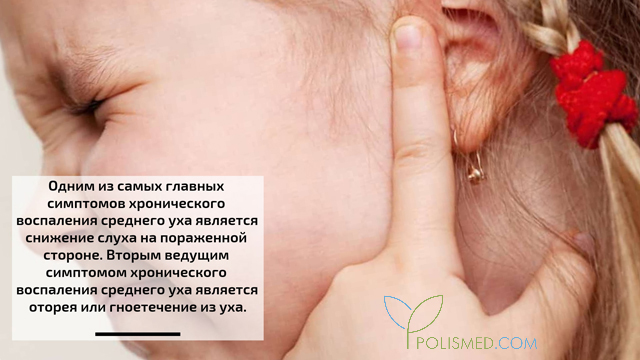 Симптомы воспаления среднего уха