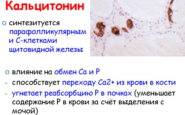 Кальцитонин
