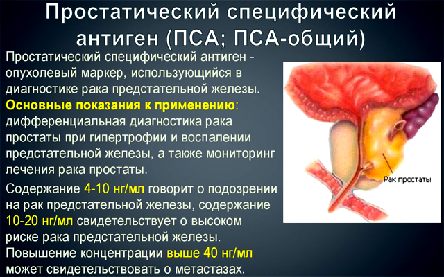 Простатический специфический антиген