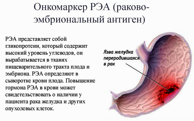 Раково-эмбриональный антиген