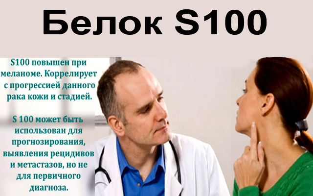 Белок S100