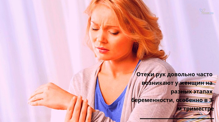 Отеки рук у женщины