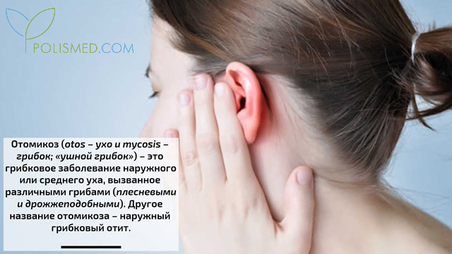 Отомикоз
