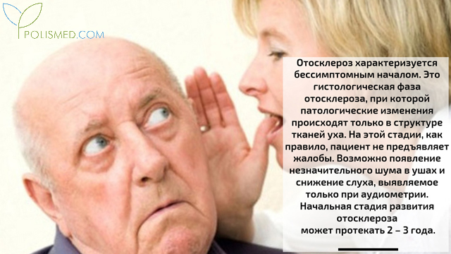 Симптомы отосклероза