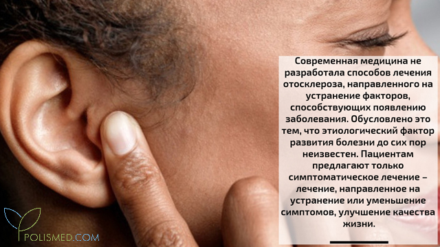 Лечение отосклероза