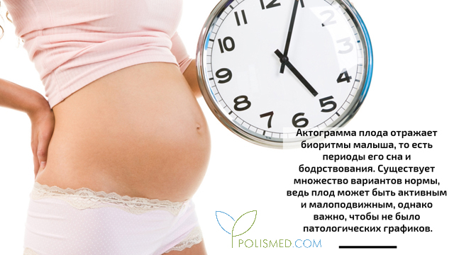 Тест шевелений плода