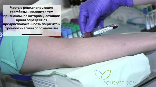 Диагностика тромбофилии