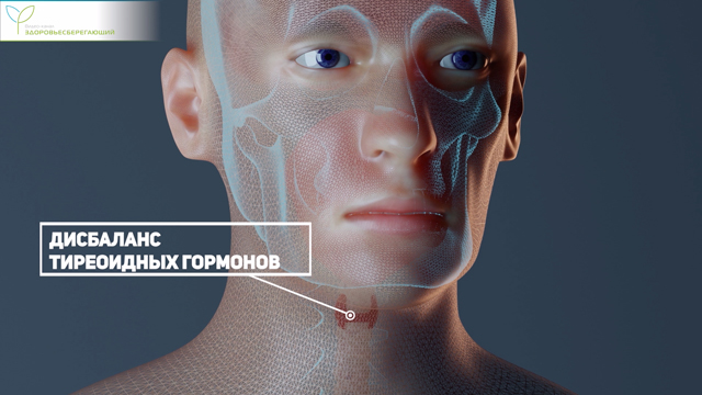 Дисбаланс тиреоидных гормонов