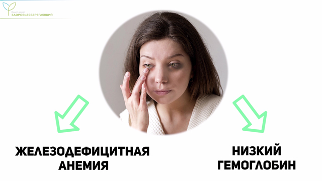 Причины кругов под глазами