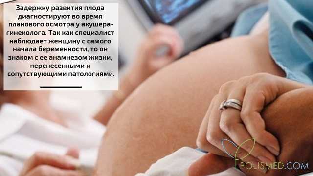 Диагностика задержки развития плода