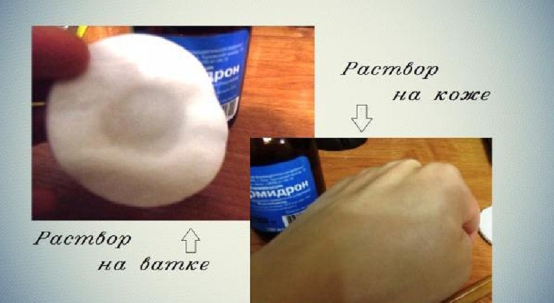 Как выглядит Формидрон