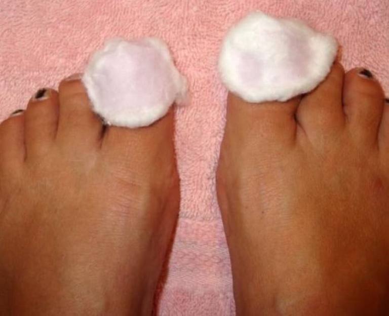 Примочки для ногтей ног