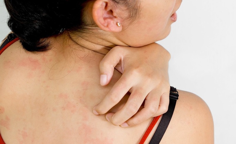 Зуд на коже