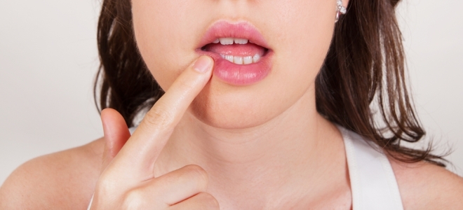 Ангулярный хейлит